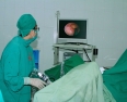 Bệnh viện triển khai Kỹ thuật nội soi tán sỏi niệu quản ngược dòng bằng laser
