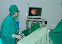 Bệnh viện triển khai Kỹ thuật nội soi tán sỏi niệu quản ngược dòng bằng laser